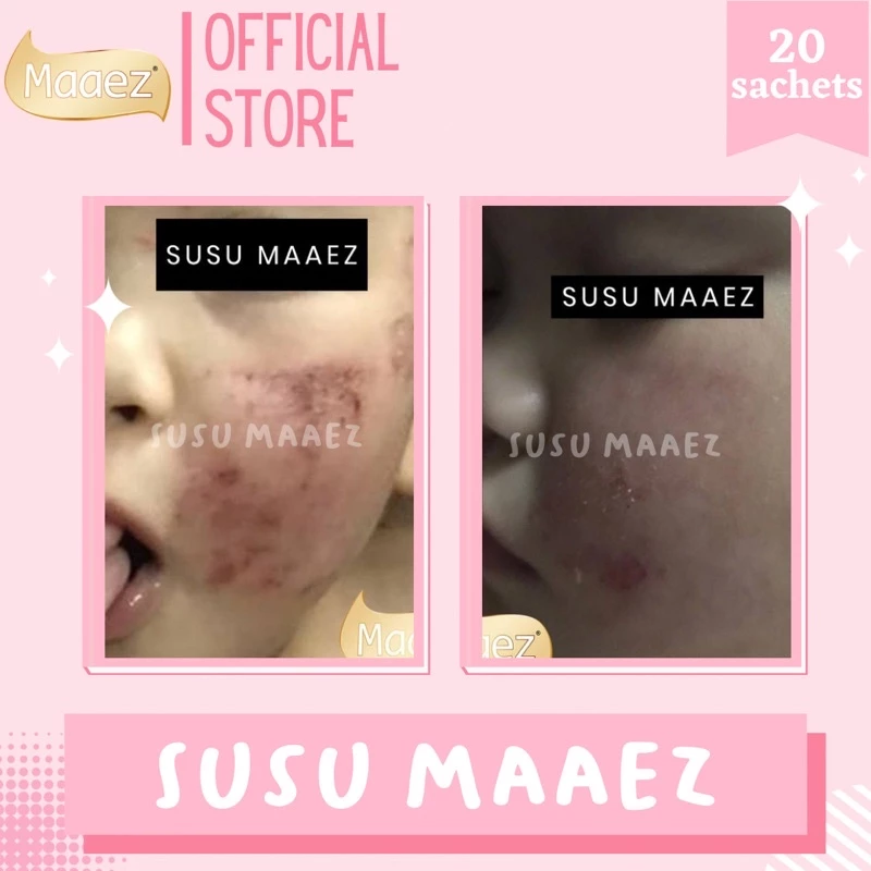 SUSU MAAEZ NEW EDITION